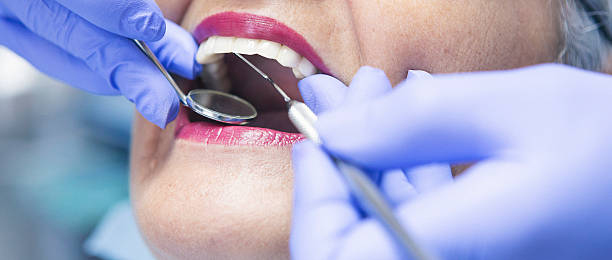 Best Weekend Emergency Dentist in Blue Ridge, VA